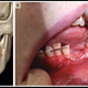 Imagen para el artículo titulado Este joven tiene la boca sellada después de fracturarse la mandíbula y los dientes al estallar su cigarro electrónico